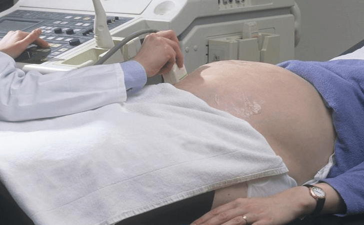 怀孕期间增加使用超声波会导致自闭症吗?