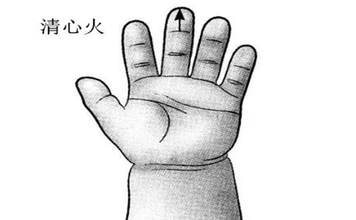 自闭症孩子推拿手法 自闭症孩子推拿手法