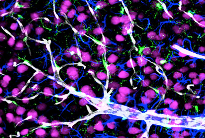 神经元燃料:由自闭症相关基因SLC7A5编码的蛋白质帮助运送大氨基酸通过血脑屏障来喂养发育中的细胞。