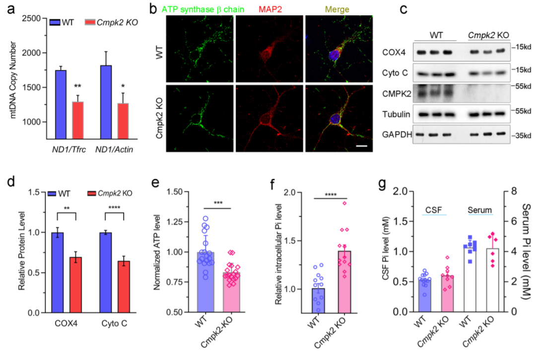 Cell Discovery：CMPK2基因缺陷导致线粒体障碍和家族性脑钙化症