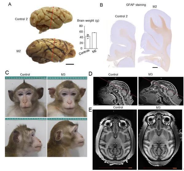 培育CHD8基因突变自闭症猴模型，剖析其病理机制