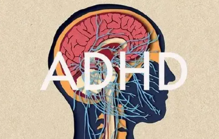 ADHD护理原则
