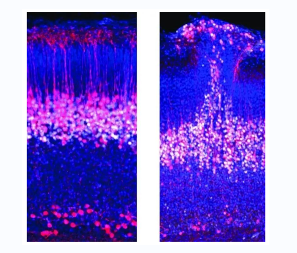 正常小鼠的第5层锥体神经元 (左) 与孤独症相关基因敲除的小鼠 (右) 相比，显示出一片无序的皮层