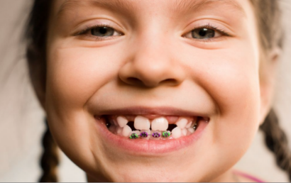 为什么ADHD儿童更容易牙齿出问题？